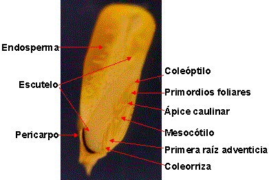 Figura 11